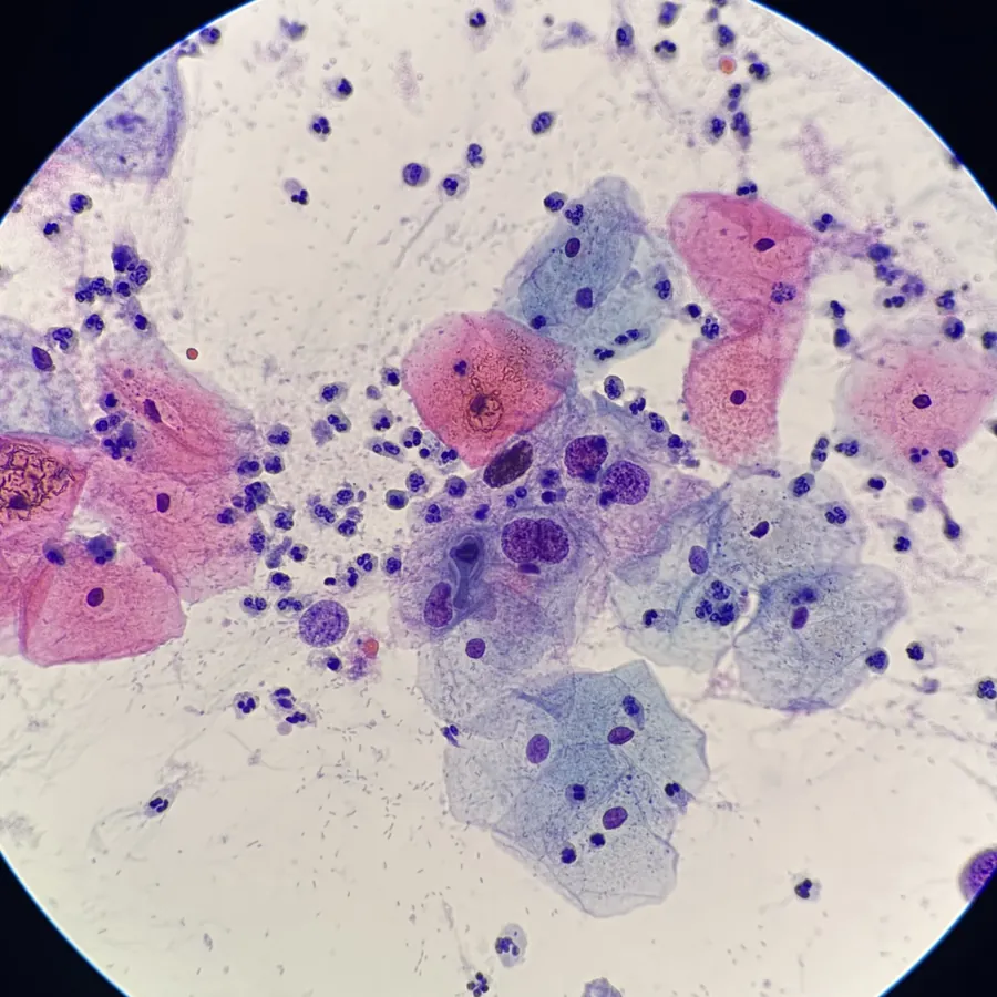Cytology smear under the microscope
